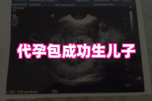 长春助孕网 4